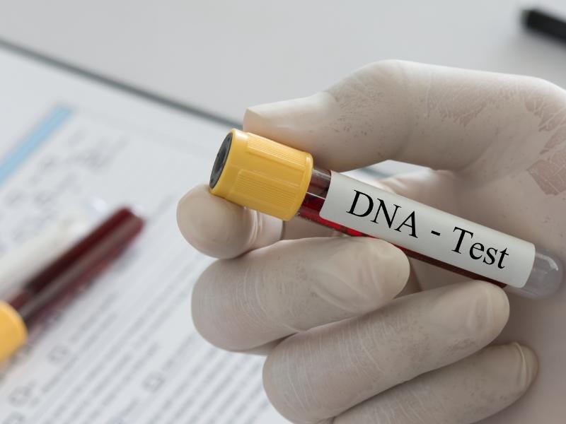 Nome do pai permanece no RG dos filhos, mesmo ap�s DNA negativo